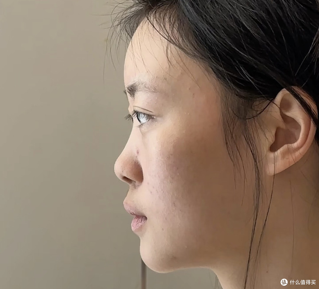 🤯脸型问题 80% 是牙齿问题:柳柳那张旧照戳中了 1 亿中国男人