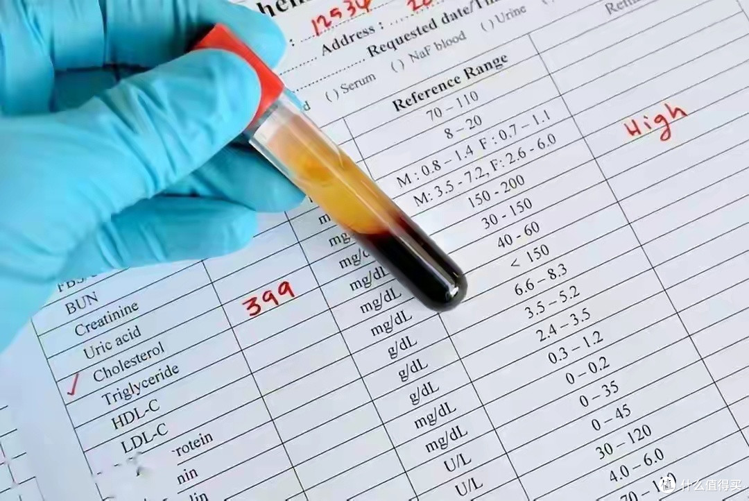 高血脂患者科学选肉指南