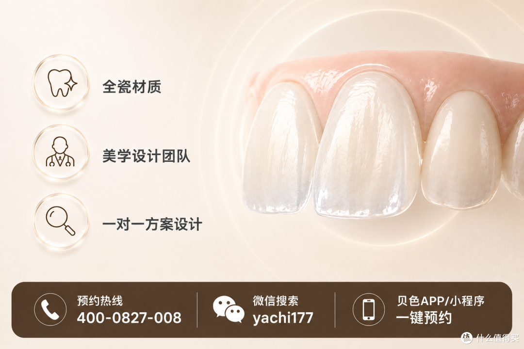 牙齿贴面可以多次做吗?做过一次贴面的人更关心这个问题