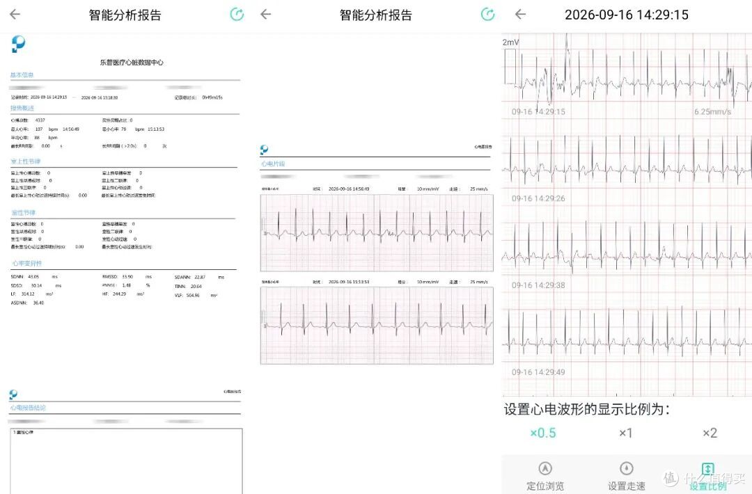 自带4G网络+AI免费分析,乐普W20心电手表才是打工人的健康搭子