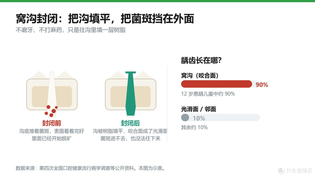 封闭做的事很简单：把深沟变成光滑面