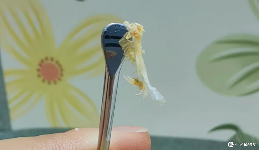 为什么耳廓一圈总是油腻腻的,有时候还会有皮屑?