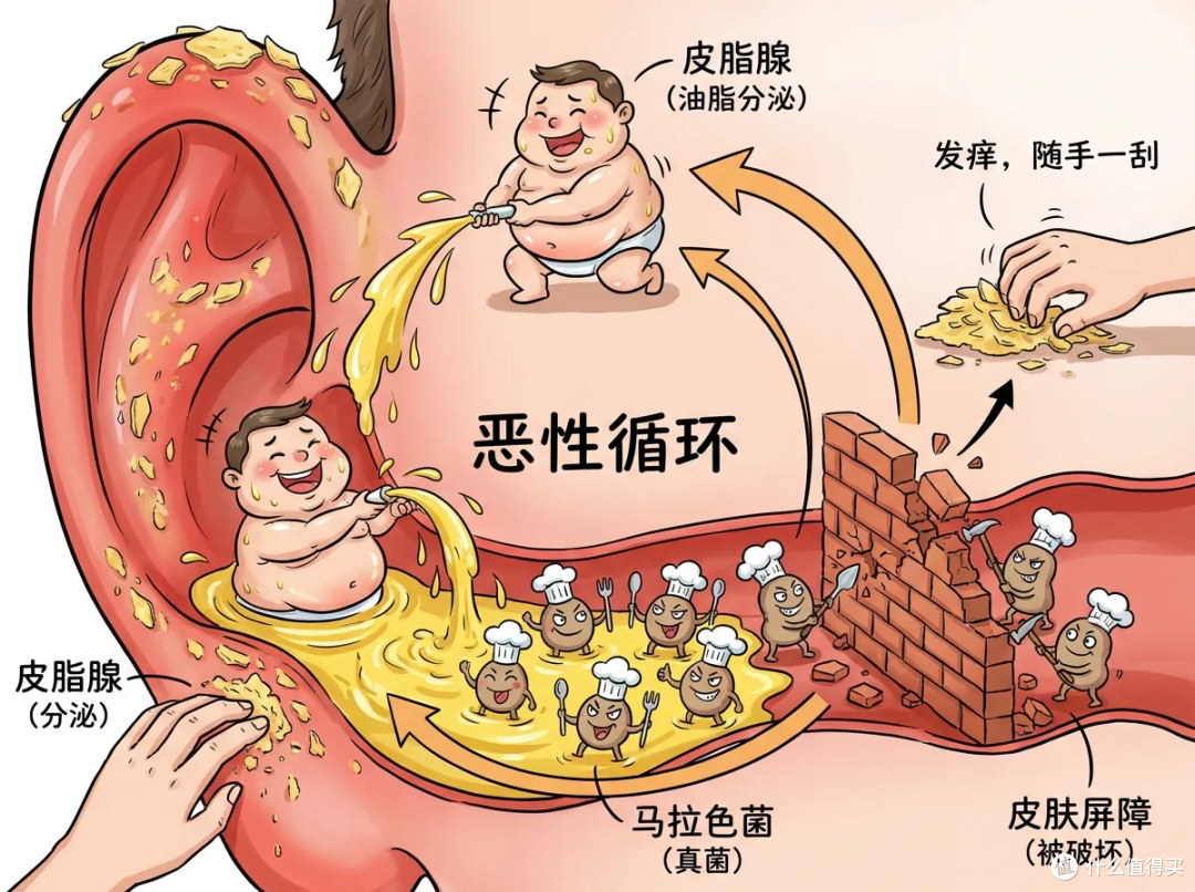 为什么耳廓一圈总是油腻腻的,有时候还会有皮屑?