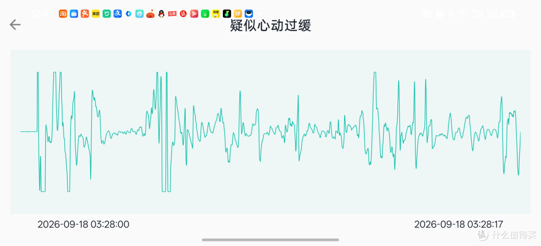 加班的人,该给自己留一块"心脏安全区"了,乐普le-W20心脏健康手表