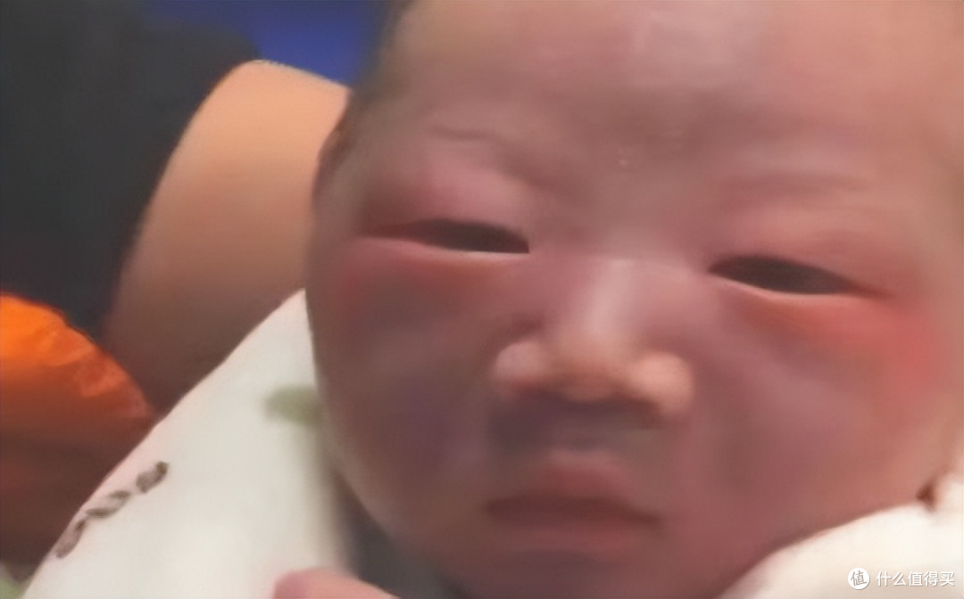 高鼻梁爸妈为啥生出塌鼻子宝宝？宝宝鼻子什么时候定型？