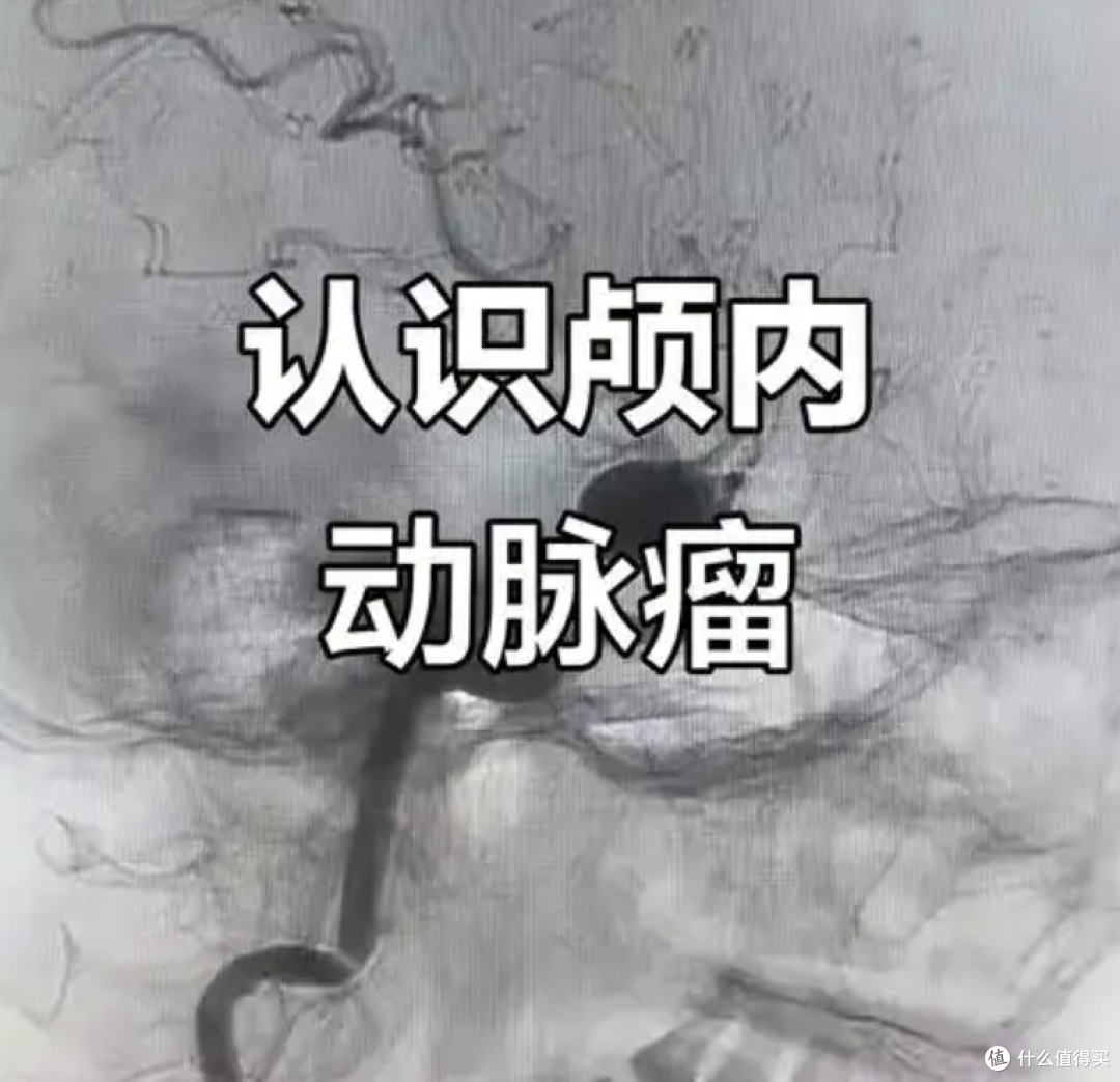 脑出血不是“老年病”!专挑这5种人下手,第5种你可能天天在做!