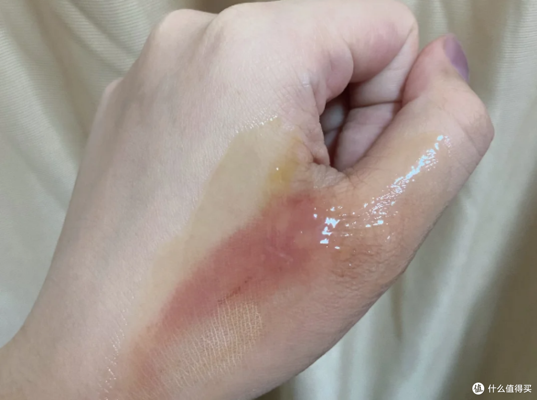 烧伤疤痕修复产品测评,4款疤痕护理使用分享