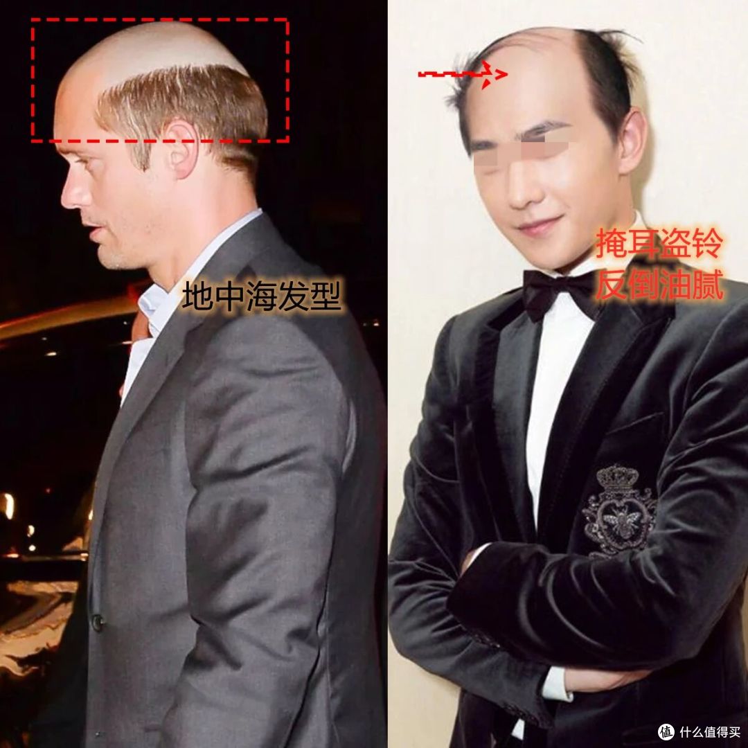 中年男人变油腻,不怪“发福”,都毁在这5种“发型”上