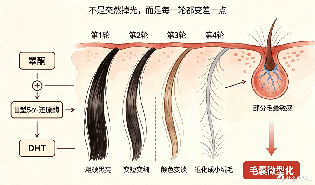 同头不同命：后脑勺这圈头发，还够不够植一次？