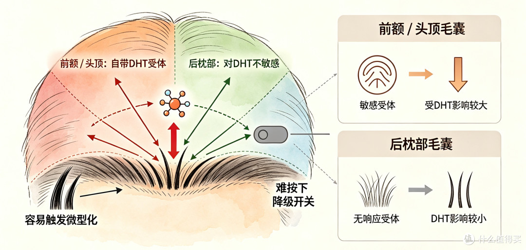 同头不同命：后脑勺这圈头发，还够不够植一次？