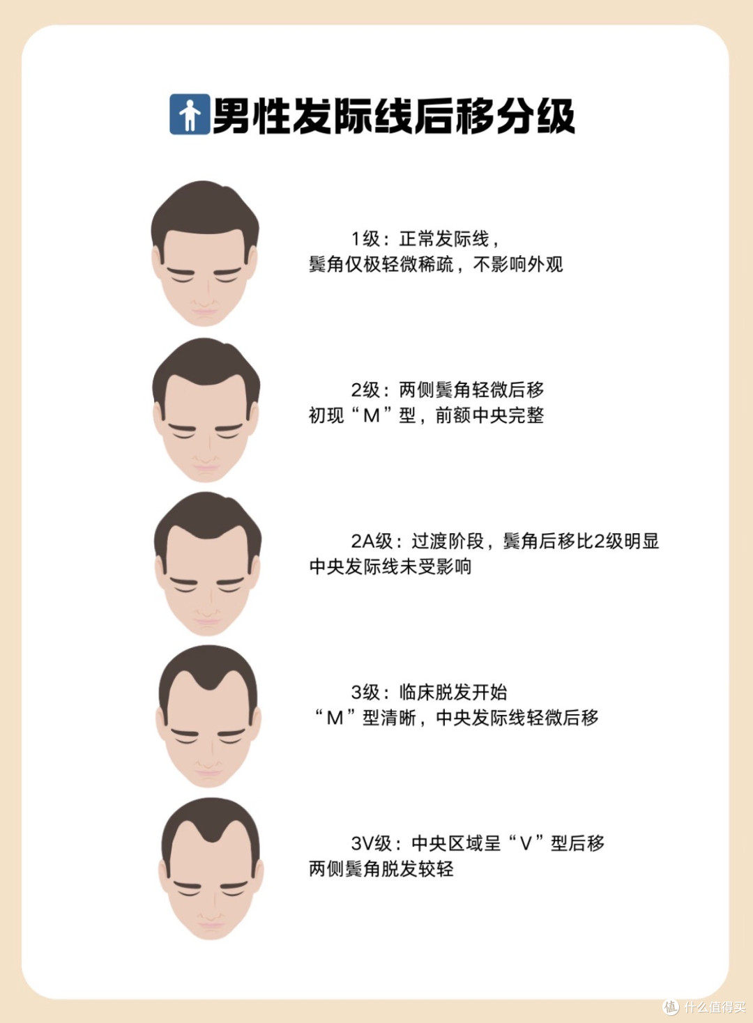 植发都用上机器人了,男生发际线后移还有救吗?