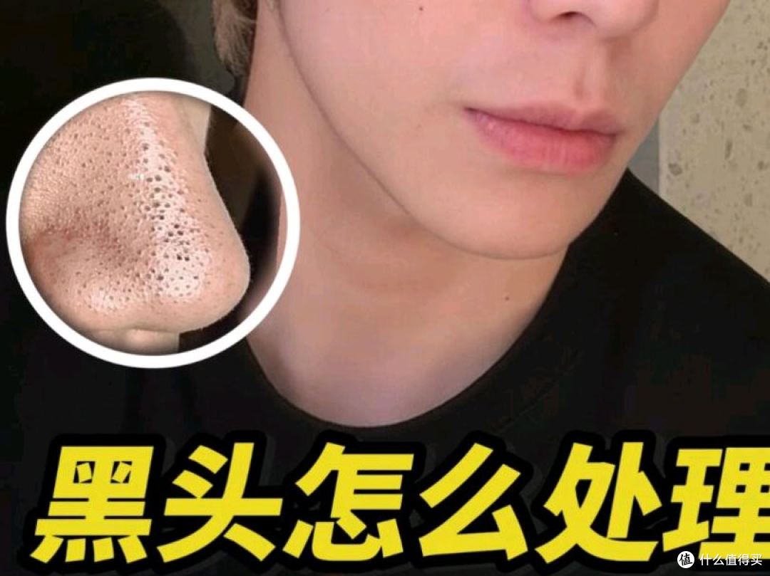 男生护肤品别乱买 这3瓶搞定油皮所有问题