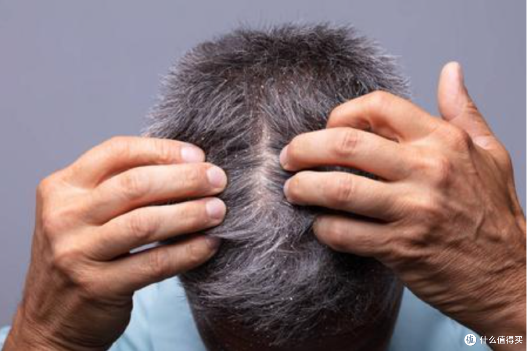 糙老爷们的体面自救指南:头屑、脱发、体味、牙黄,别指望肥皂了