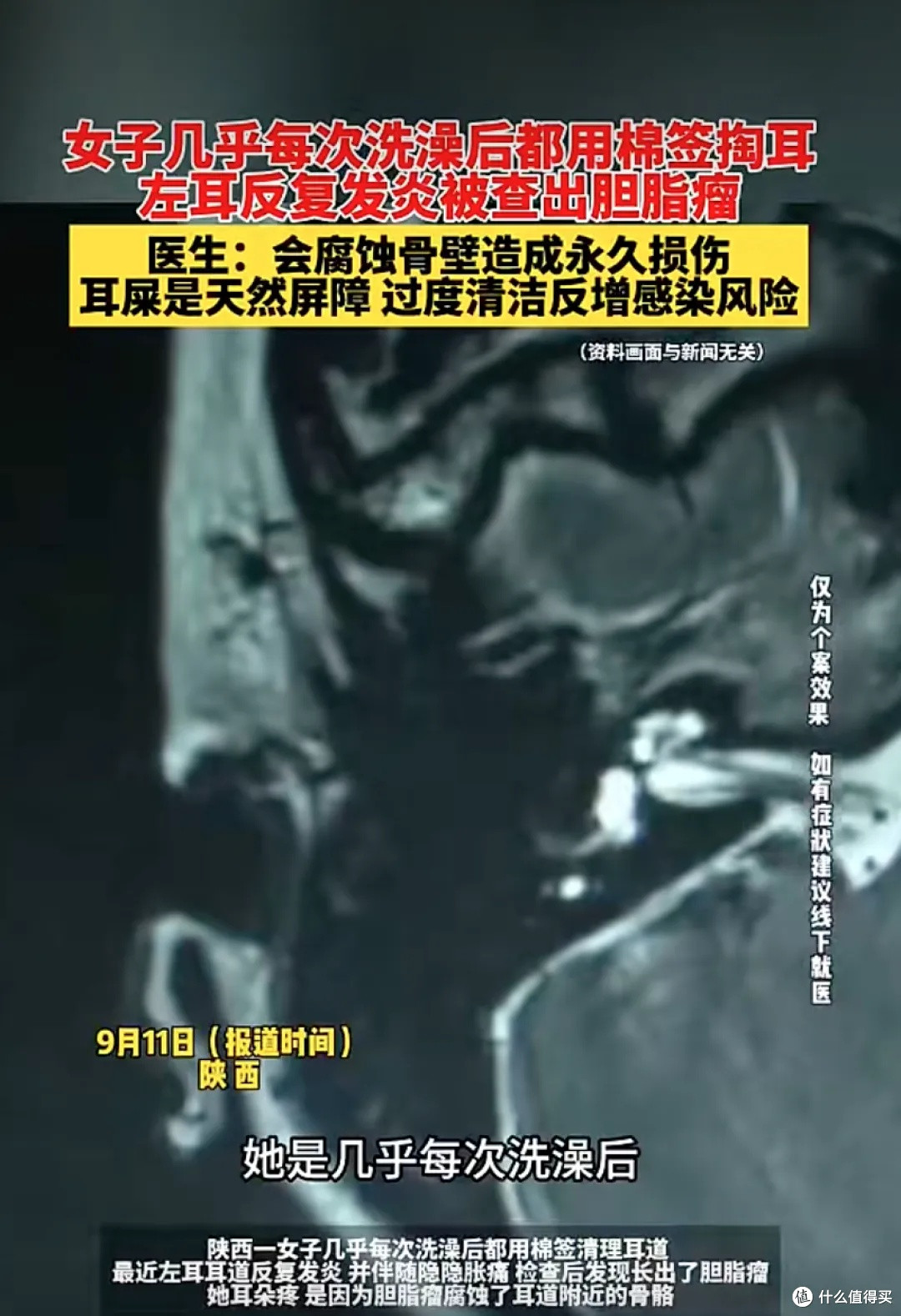 洗澡后千万别再拿棉签掏耳朵了!