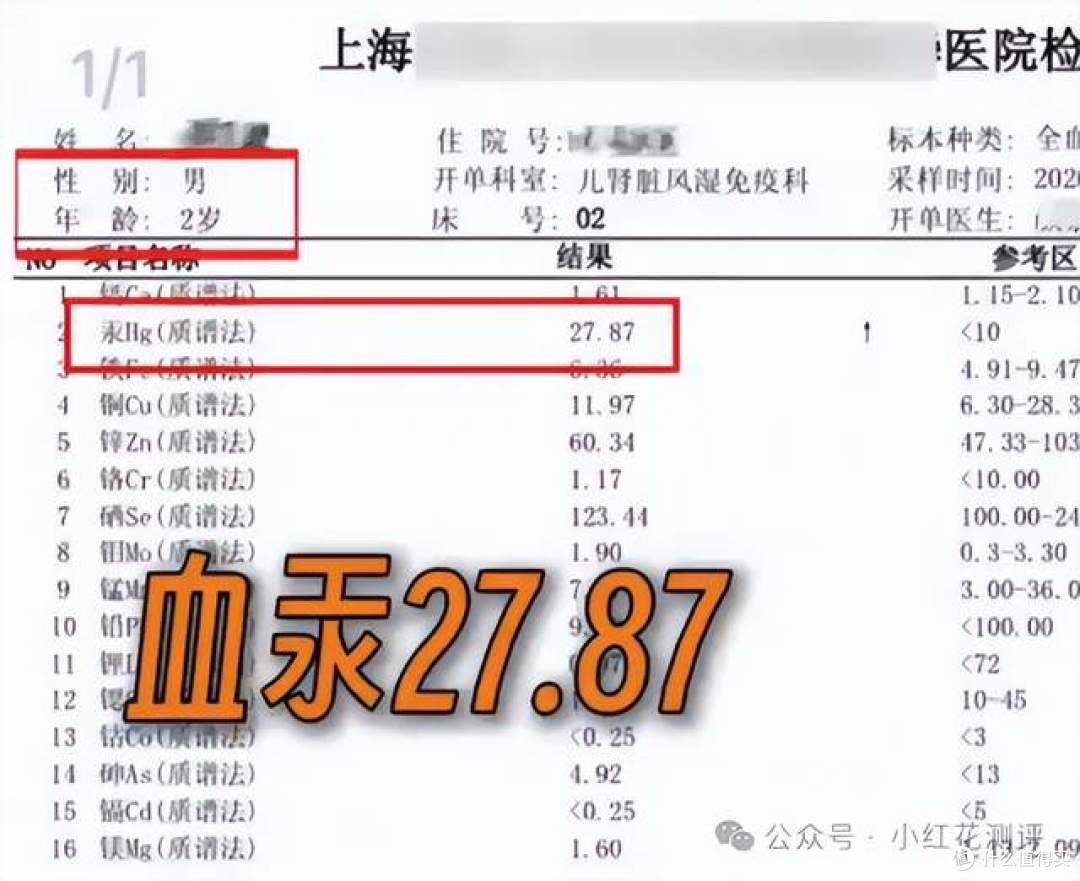 吃银鳕鱼导致汞中毒?你以为的高级辅食,可能正在害你的娃!