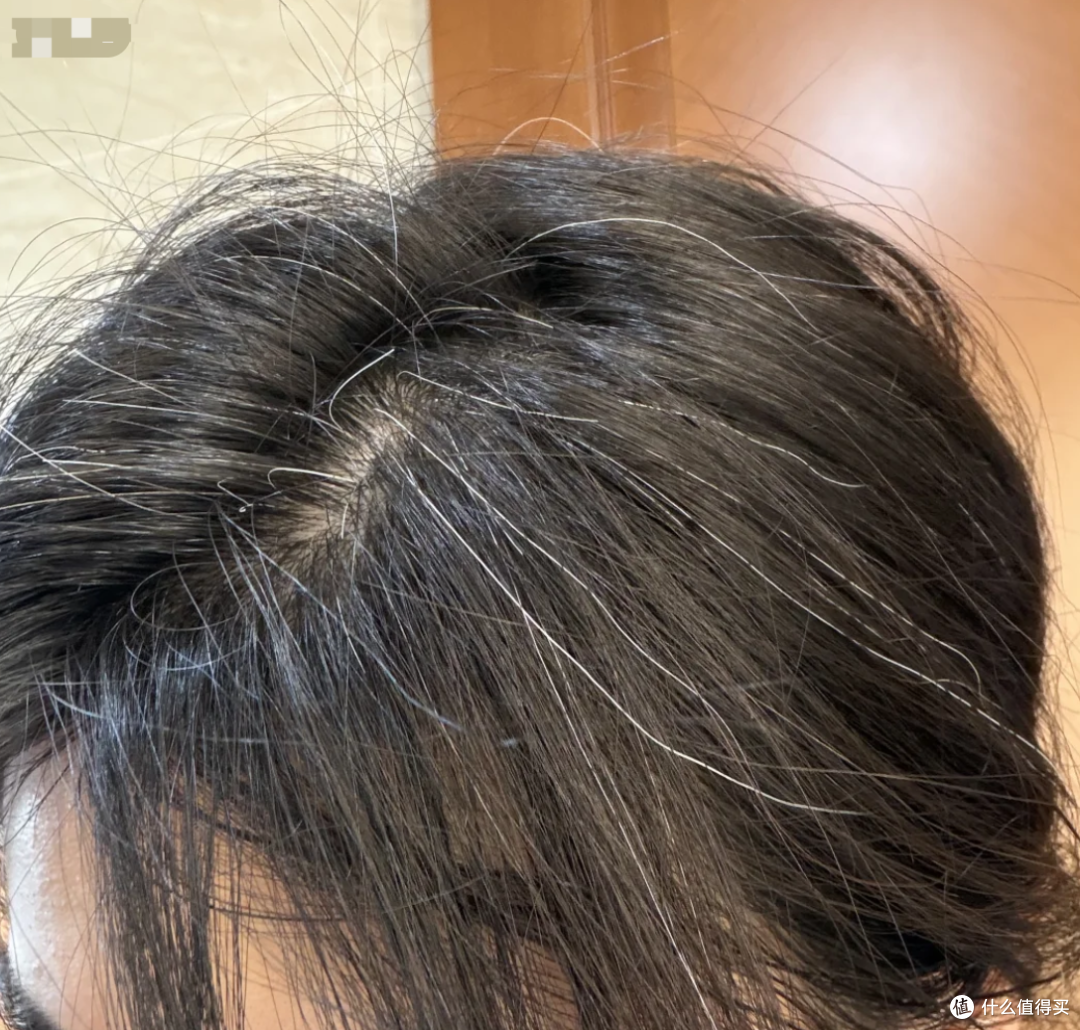 央妈认证：长白发，可能是身体在发出预警信号，5招养出一头秀发