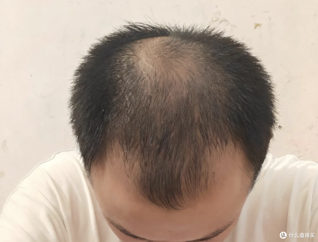 央妈认证：长白发，可能是身体在发出预警信号，5招养出一头秀发