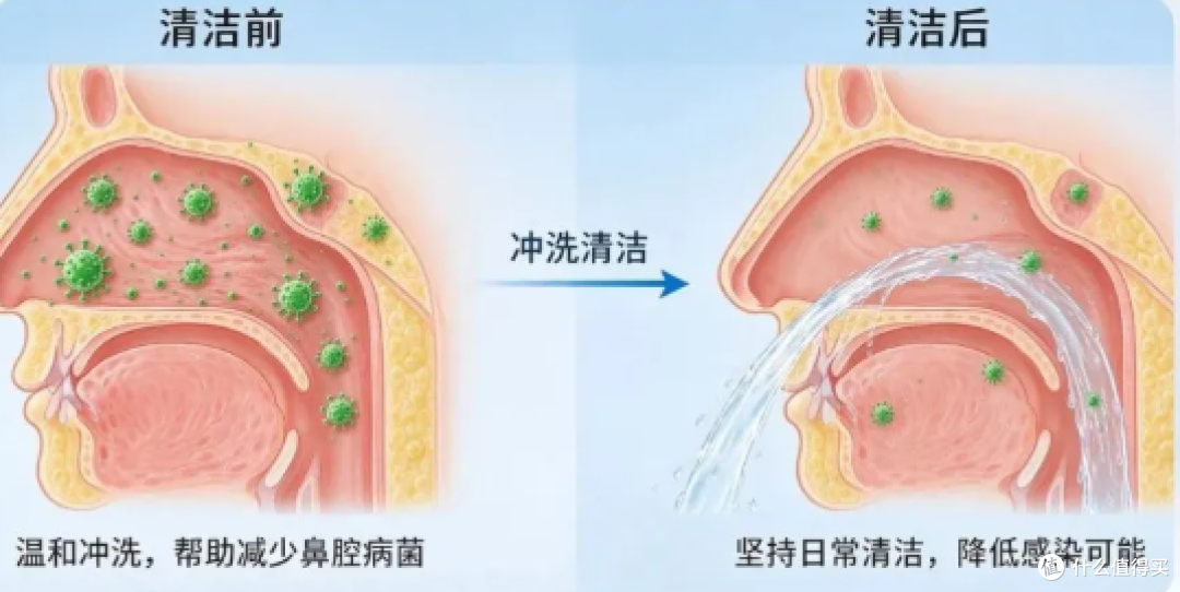 鼻病毒检出率走高｜守护呼吸道，鼻腔清洁别忽视！