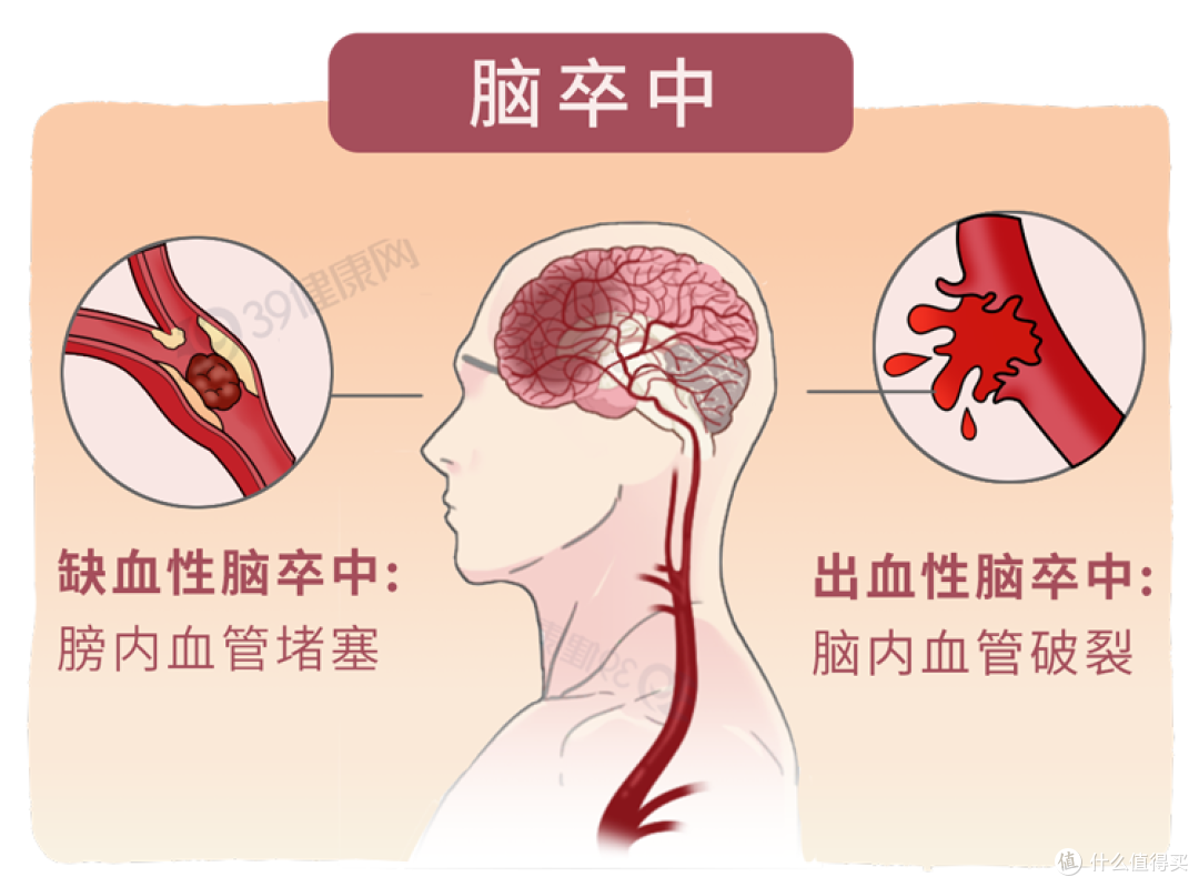 53岁男子突发脑梗去世,医生:晨起不要做2件事,加大脑梗风险