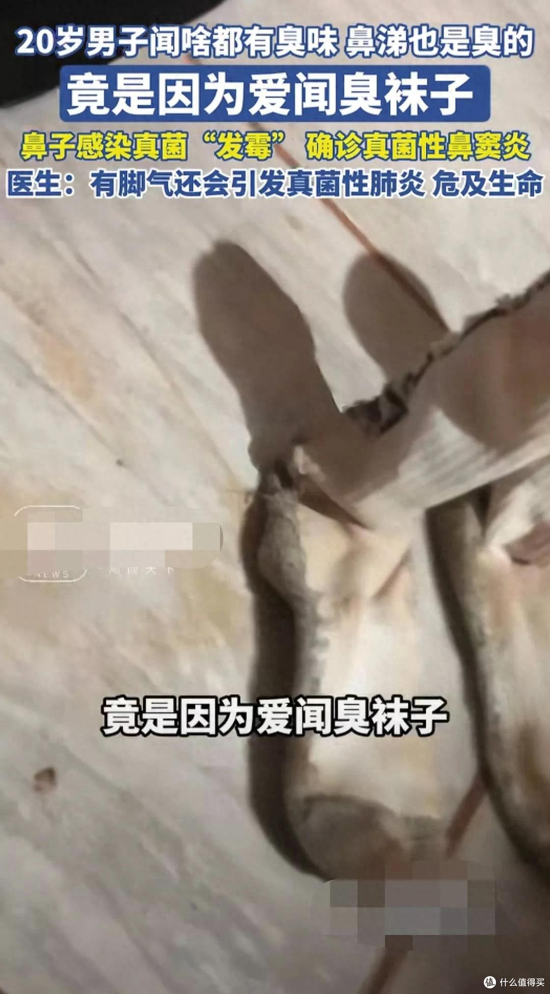 偷偷闻袜子的第一批受害者,出现了 —— 不是脚气,是真菌肺炎!