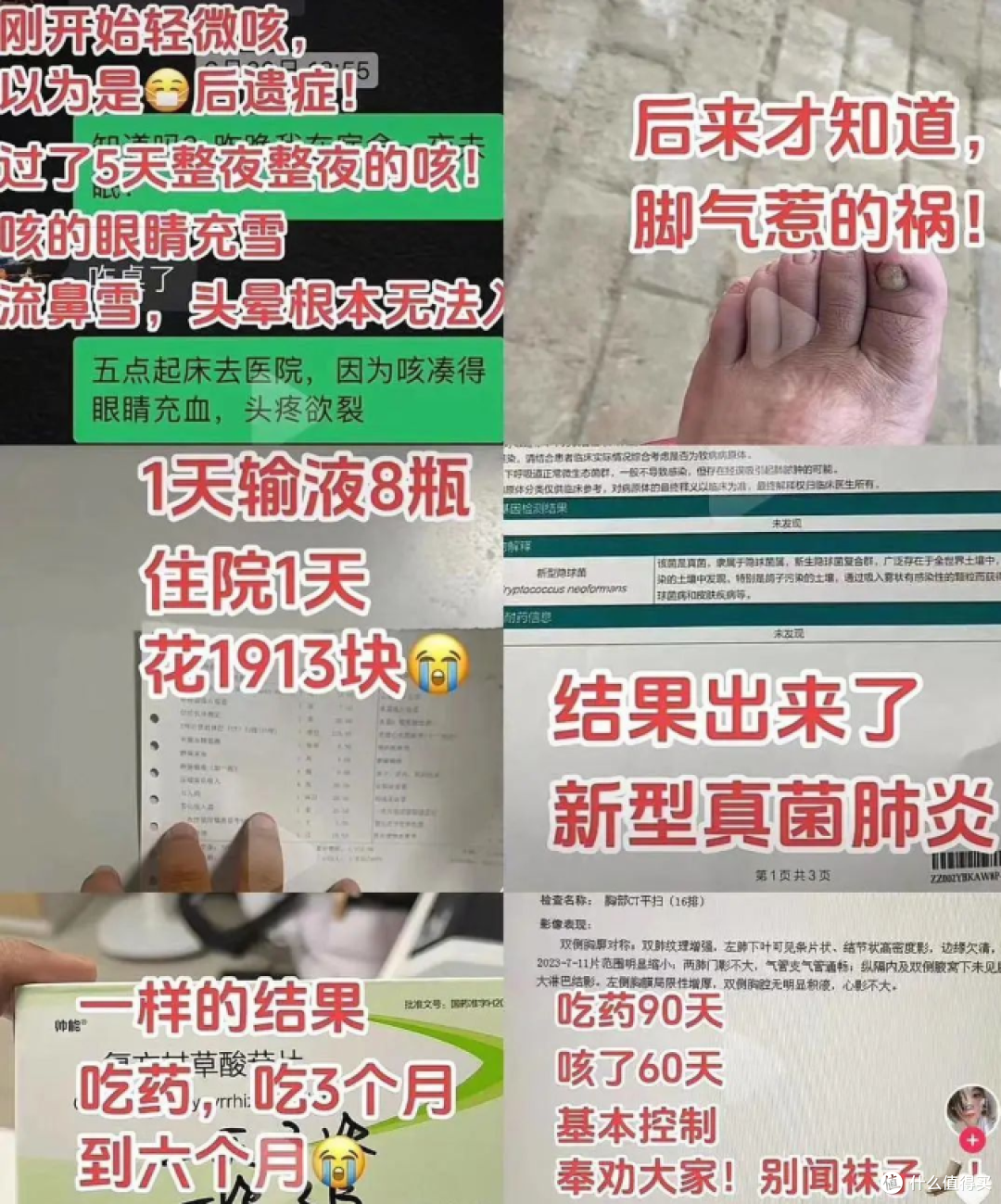 偷偷闻袜子的第一批受害者,出现了 —— 不是脚气,是真菌肺炎!