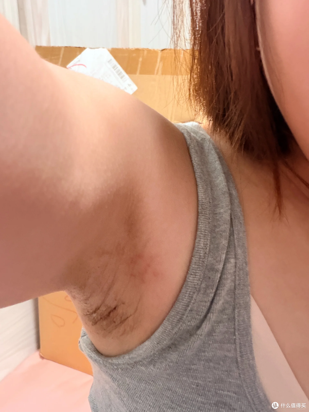 收狐霜适合做过手术的人群吗?
