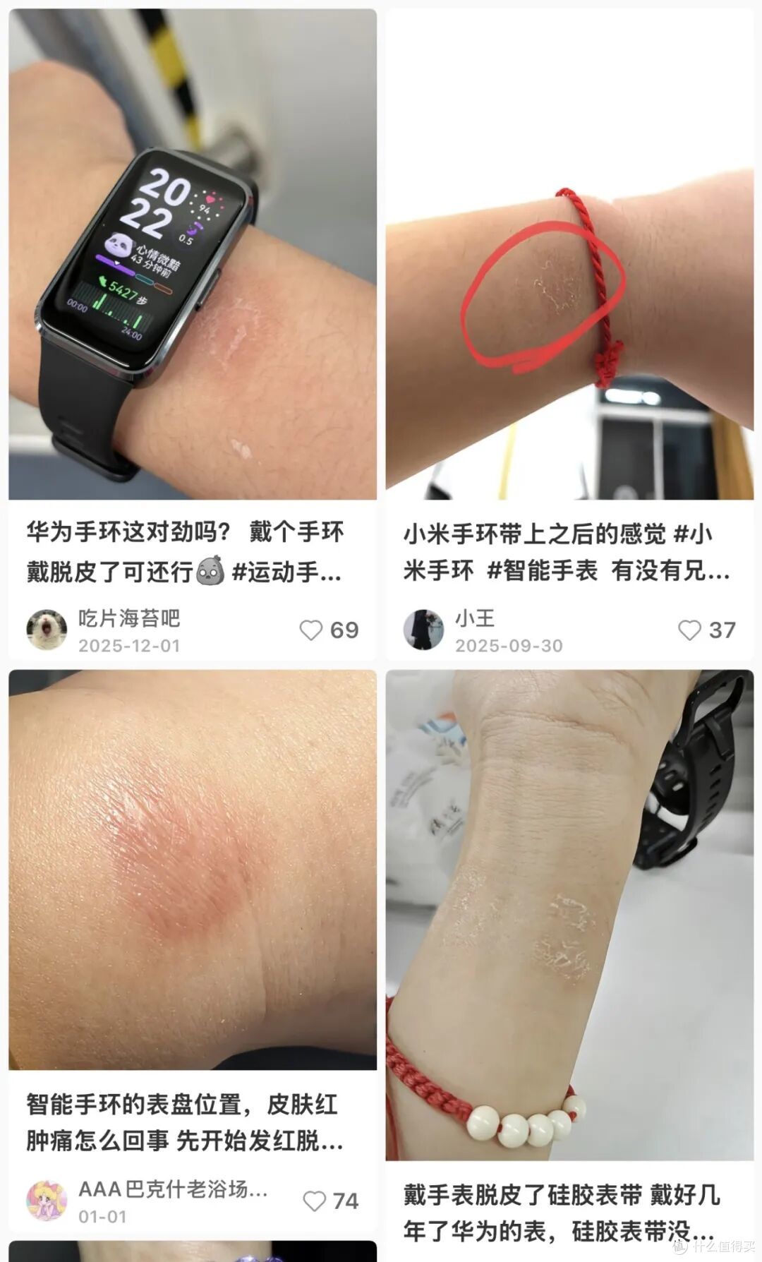 戴运动手环后,手腕发白脱皮?可能是你的皮肤在抗议!😱