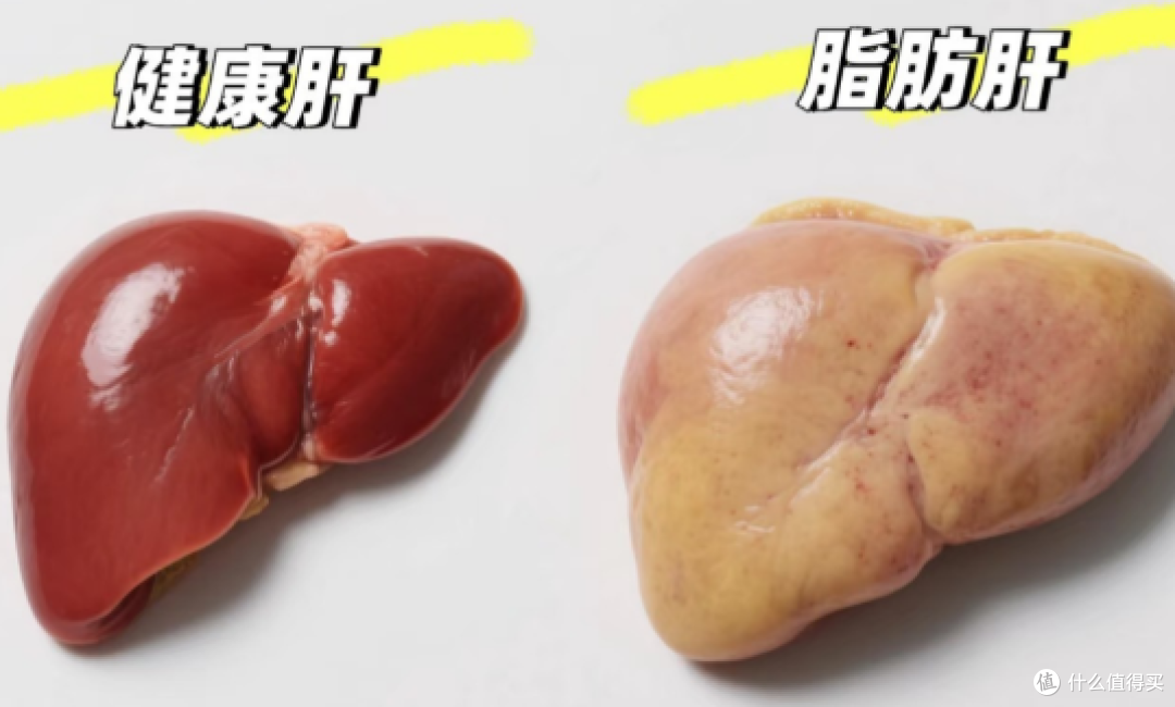 别等肝疼才重视!4类高危人群:每半年B超+甲胎蛋白筛查不能省