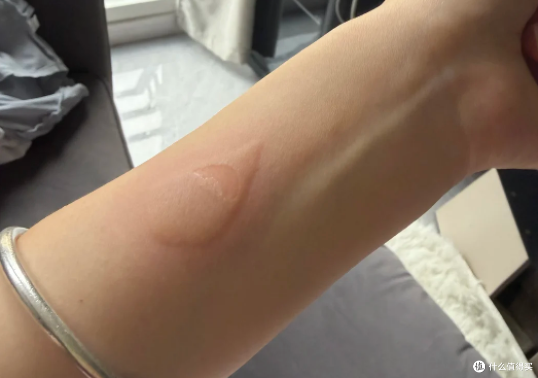 烫伤留疤后我试了4款硅酮产品,说说真实使用感受