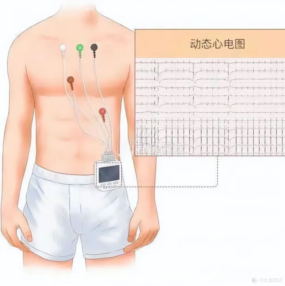 一活动就胸闷胸痛？当心劳累性心绞痛，这可能是心脏在喊救命了！
