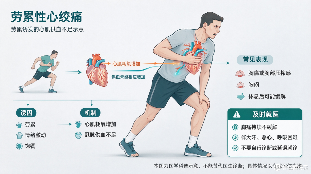 一活动就胸闷胸痛？当心劳累性心绞痛，这可能是心脏在喊救命了！