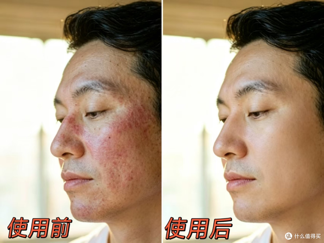 男生皮肤稳定也要修护?这款胶原敷料我实测吃透了