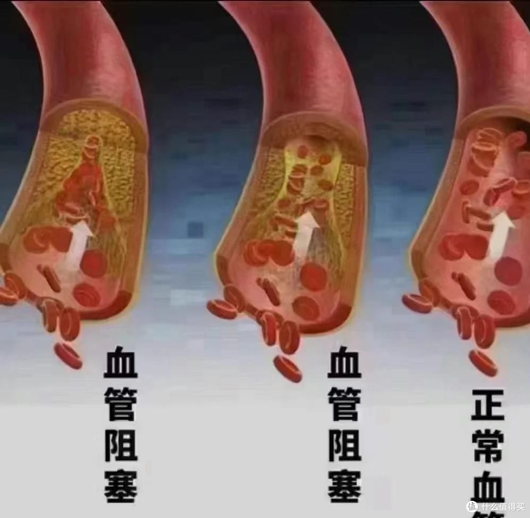 2800万人中招的病，90%其实能躲开，关键就藏在这几个日常动作里