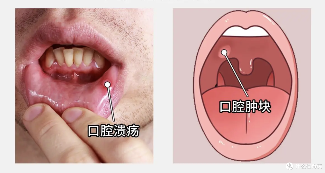 嘴里这 5 个变化，是身体在喊救命，第 2 个太容易被当成上火！