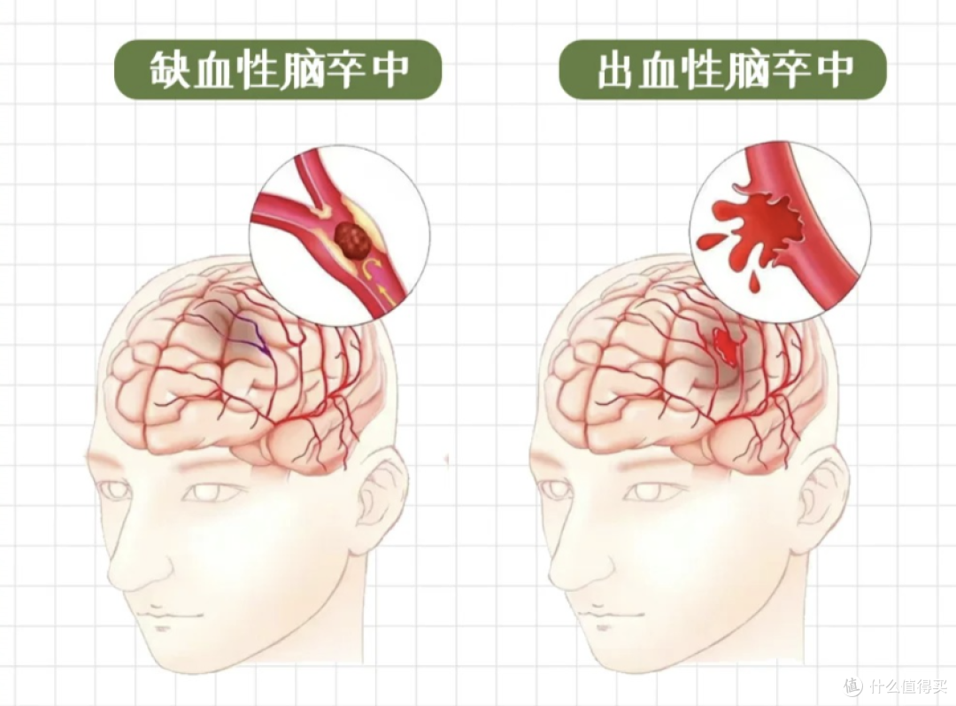 水煮菜控尿酸没用?80%尿酸自身生成,重点是做好排泄,少走弯路