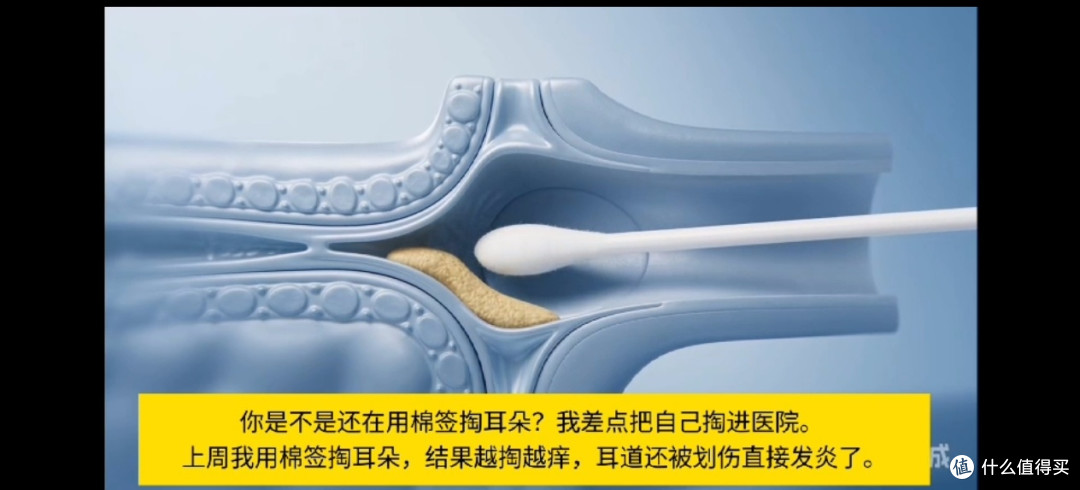 双 11 西圣 Find X 可视挖耳勺测评,在家轻松实现专业采耳