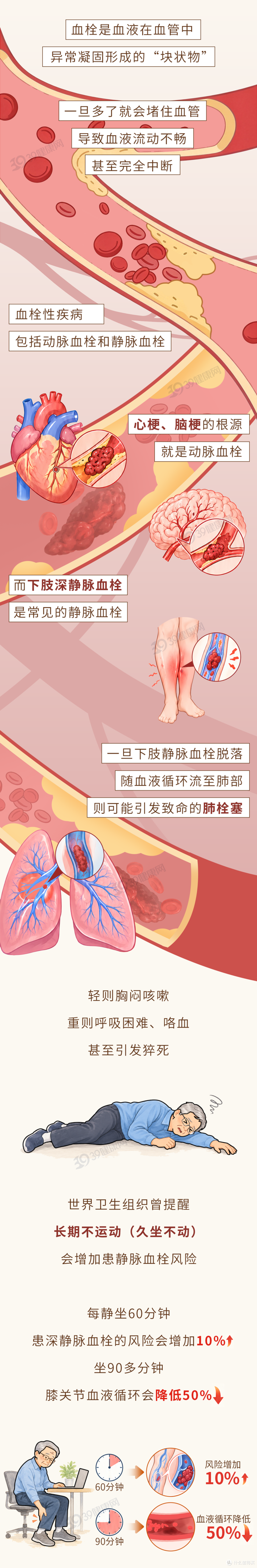 马上停止5类运动！很可能加速血栓形成，等血管“堵死”就迟了