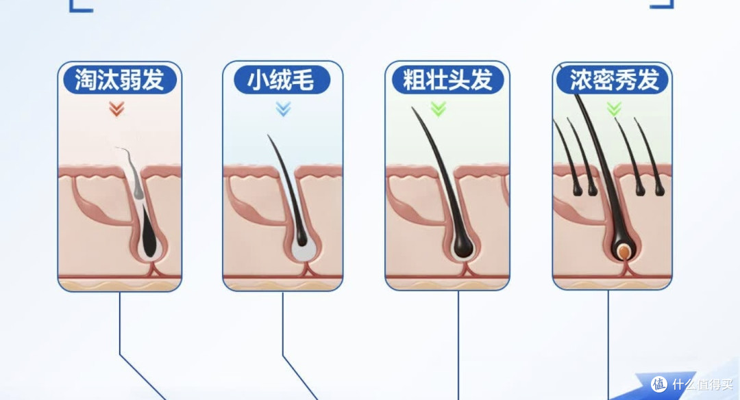 中年人秃顶，怎么保护发际线，怎么不秃顶，我来帮你，纯经验分享