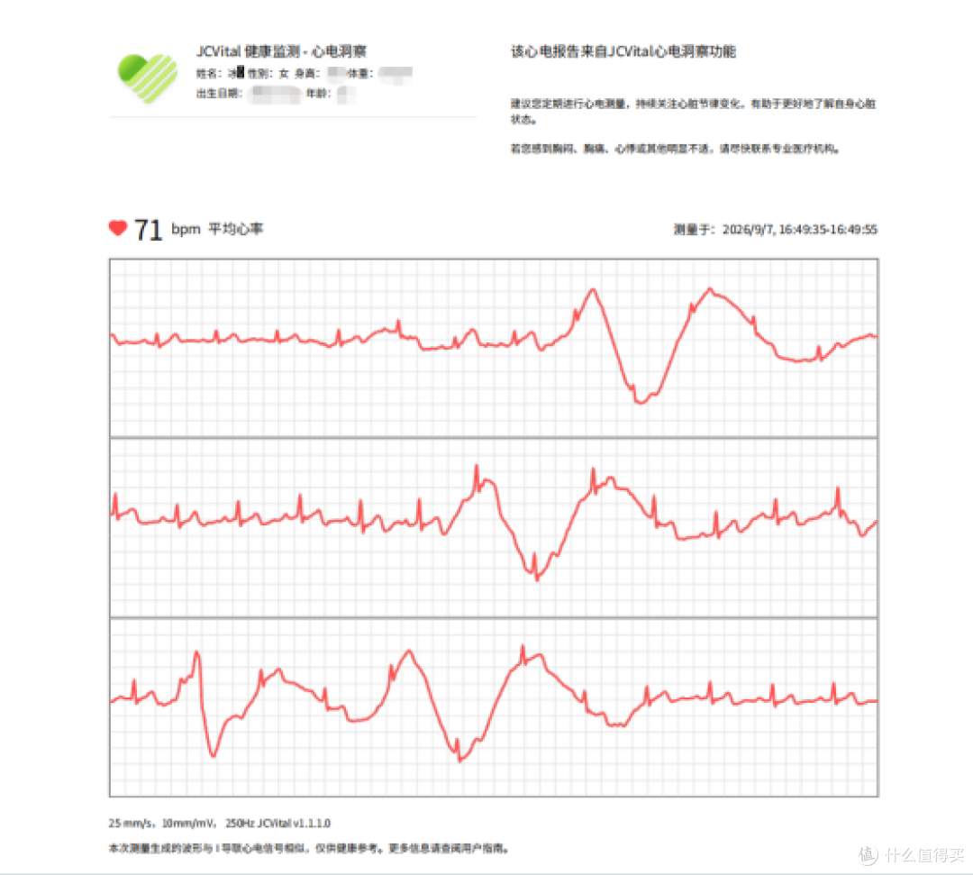戴了 31 天的无屏手环,我的生物年龄比实际年龄老了 3.2 岁