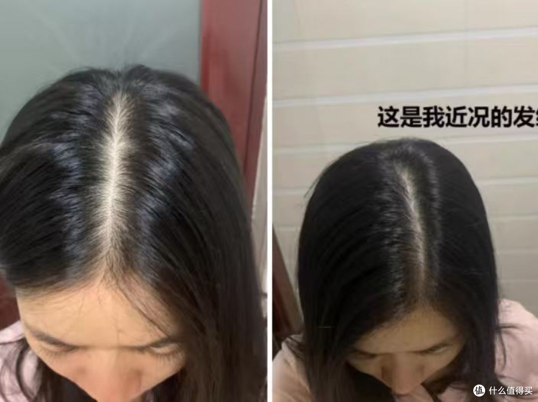 防脱洗发水怎么选?5款平价防脱洗发水,发根减负计划