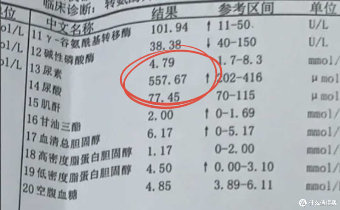 高尿酸痛风别光忌口了!学会吃够这3样,才能真的降