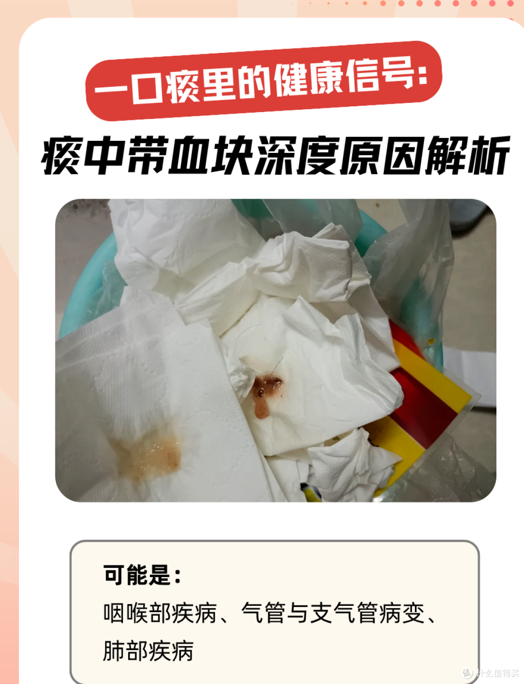 44 岁确诊肺癌，喉咙早就在报警，她却当成了咽炎！